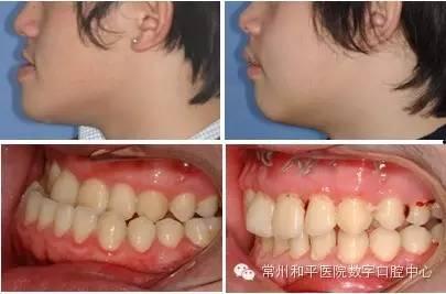 成人发声矫正方法视频,跟随视频轻松掌握发音技巧